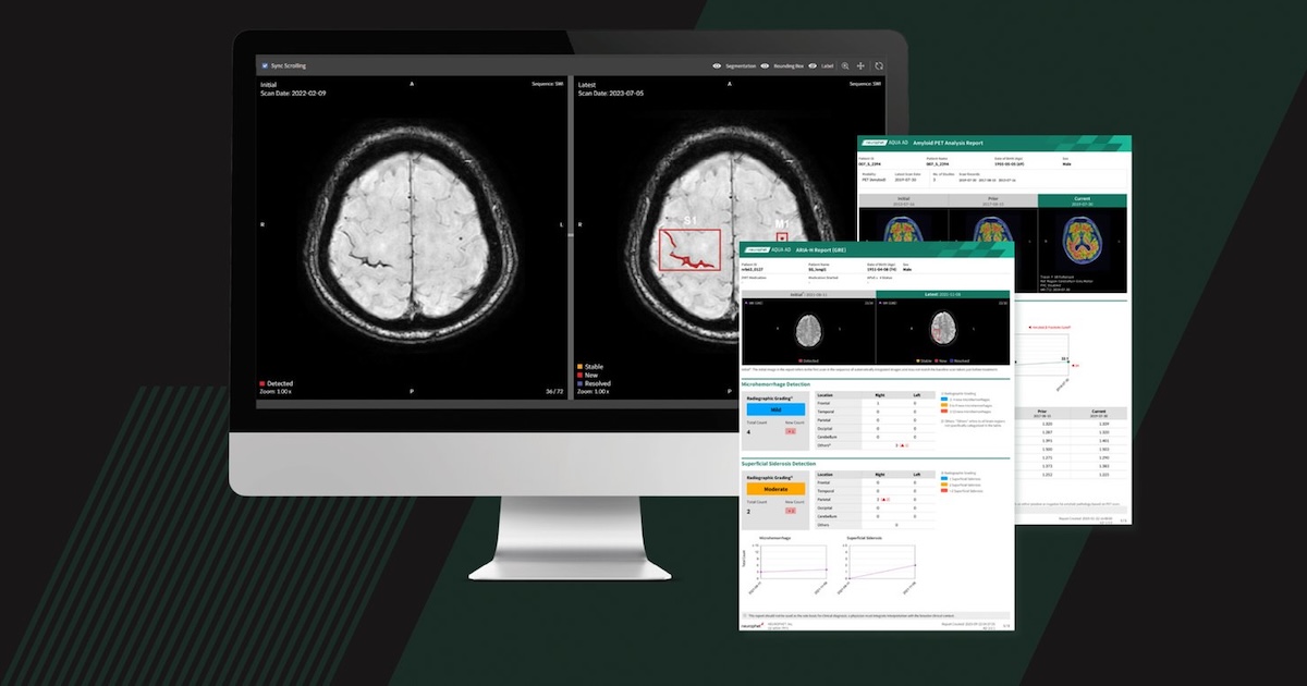 Neurophet's AI-powered Alzheimer's disease image analysis software Neurophet's AI-powered Alzheimer's disease image analysis software