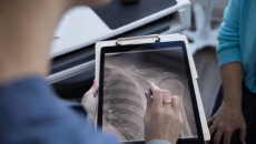 A doctor explaining findings from an X-ray image