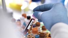 Blood samples in vacutainers. 