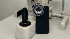 A prototype smartphone camera add-on that can detect UV damage to the eye