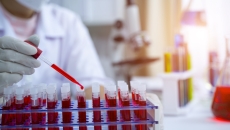 Laboratory worker working with blood tests