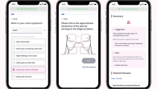 Mobile interface of Ubie's web-based AI Symptom Checker