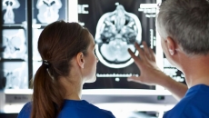 Clinicians looking at a brain scan