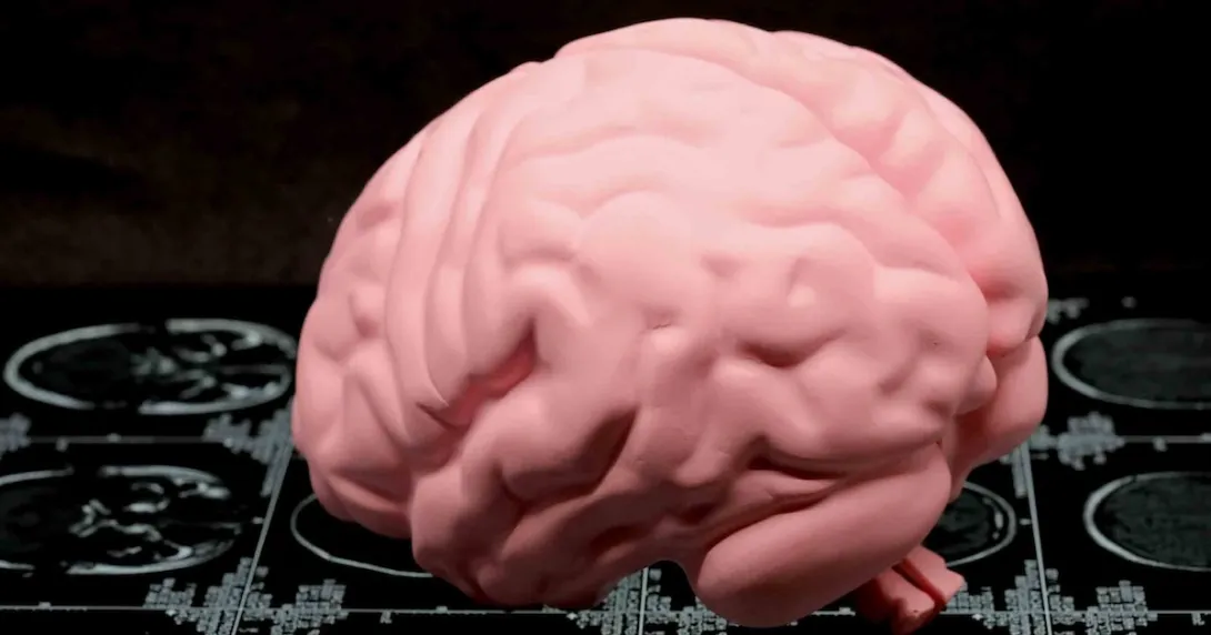 Brain injury concept