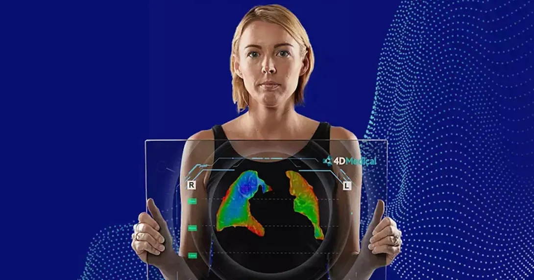 A person holding a holographic screen featuring an AI analysis of their lungs