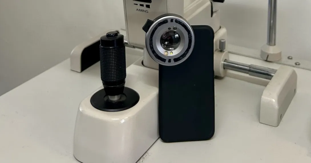 A prototype smartphone camera add-on that can detect UV damage to the eye