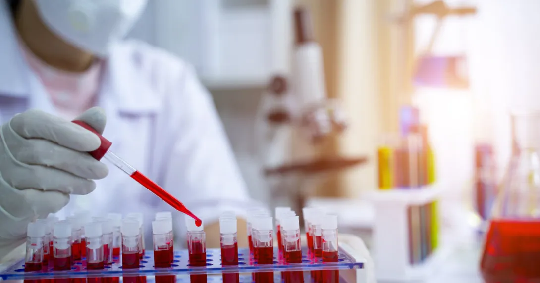 A lab assistant analysing blood samples